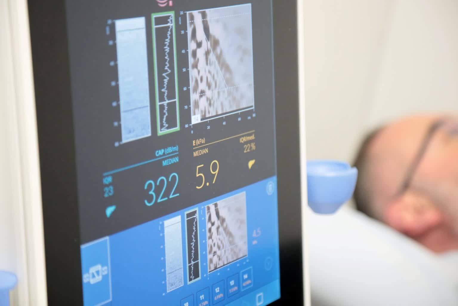 Badania wątroby w mobilnych gabinetach. Prozdrowotna akcja w Lublinie 2 pm_watroba-060323-012-2023-03-06-133608.jpg