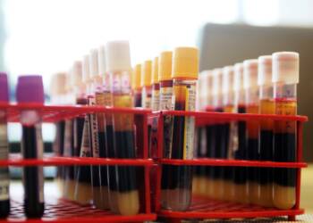 2022-01-30T12:02:24:01 ,  Fot. Piotr Michalski 
2022.01.30. SWIDNIK . ZBIORKA KRWI W KINO LOT . 
FOT. PIOTR MICHALSKI