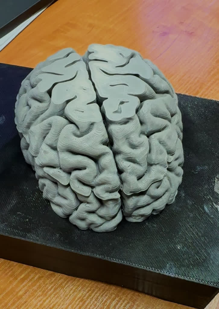 Uczelnia chcę pomóc studentom, więc... drukuje narządy 2 95fa2893-3a5a-4dac-b9dc-c38d229b92a4.jpeg