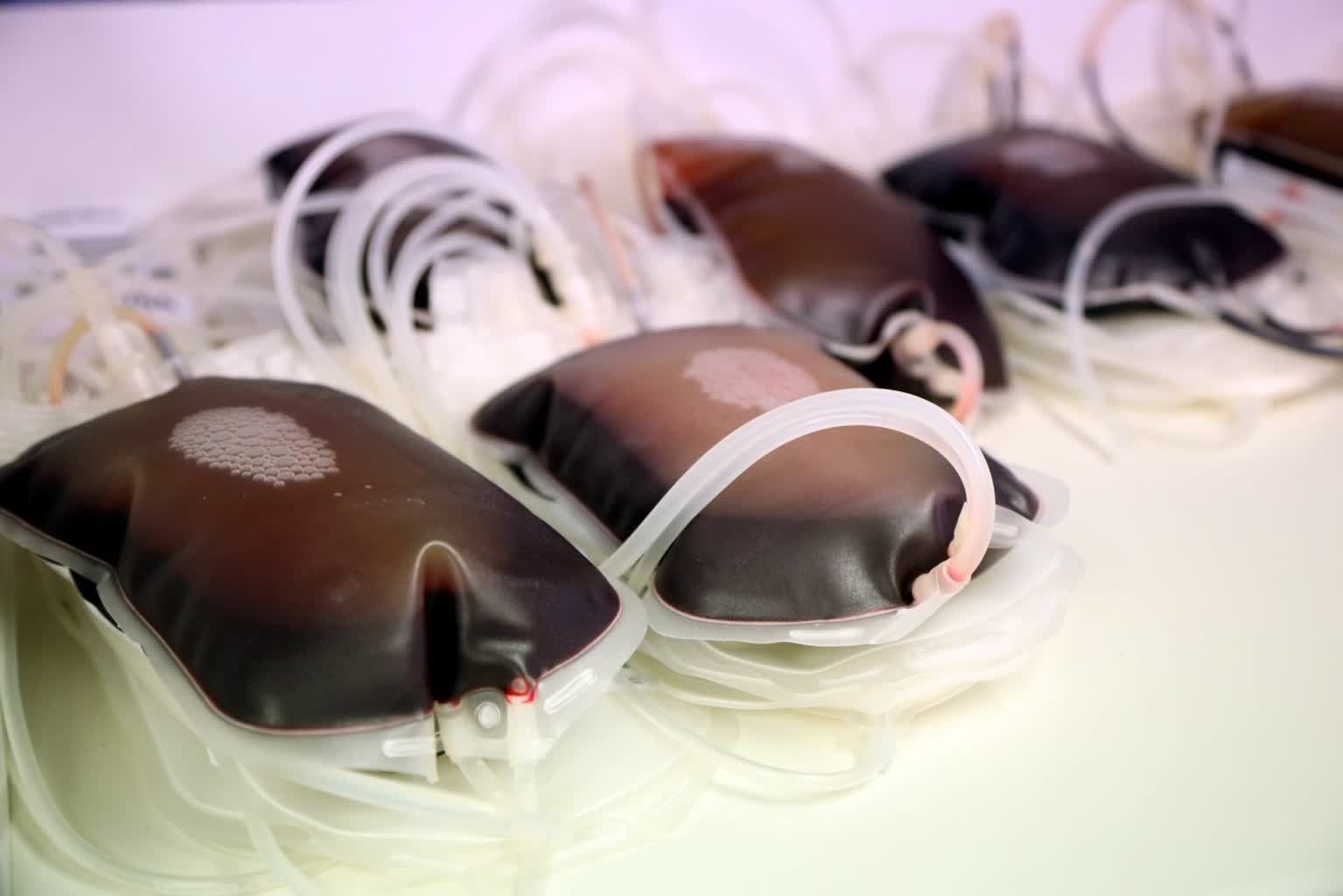 Nic jej nie zastąpi. RCKiK apeluje o oddawanie krwi 2 pm_KREW-070724-018.jpg