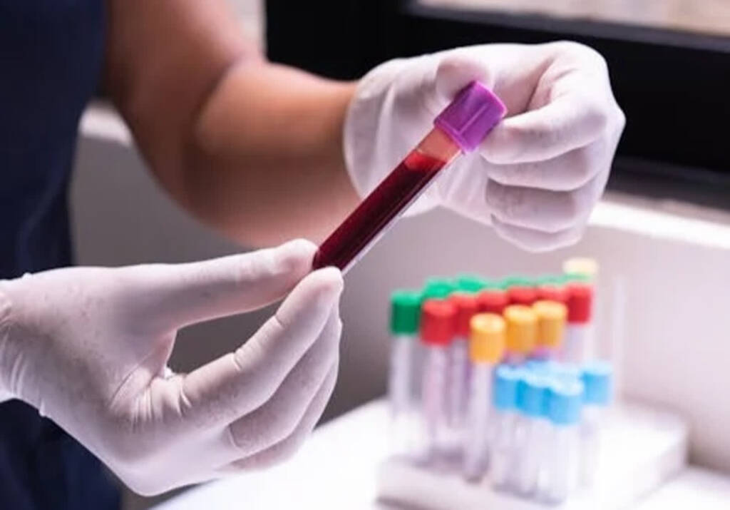 krew 2025 01 24 095341