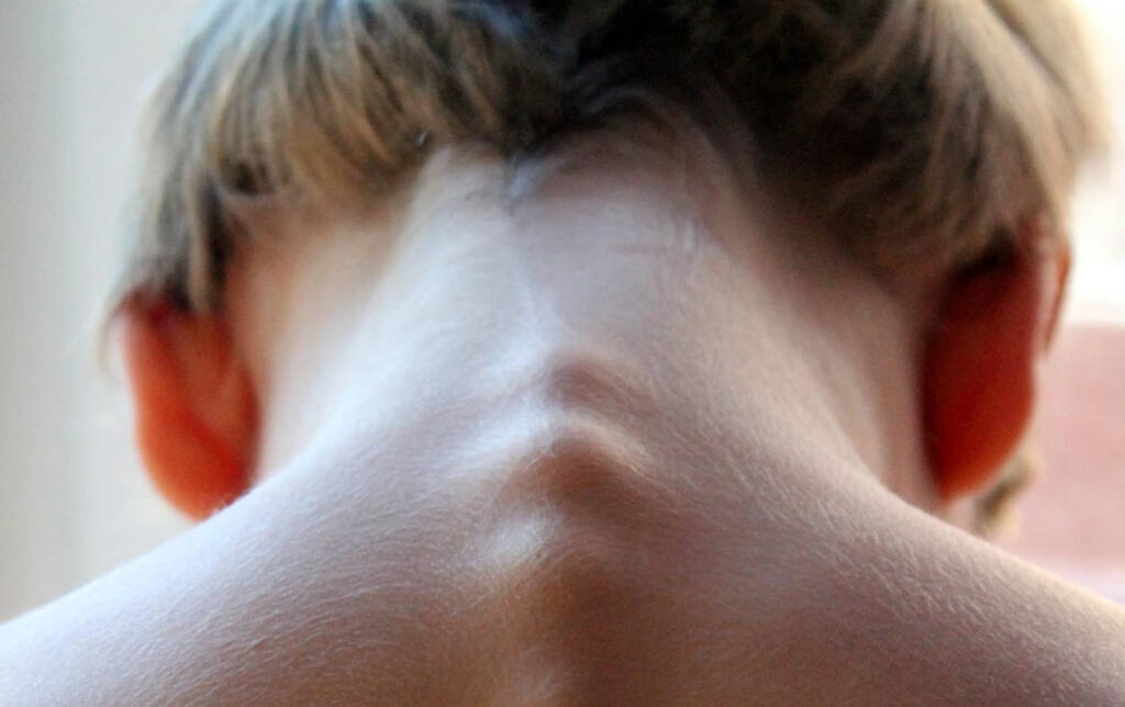 spinal column 246273 1280 2025 03 31 141941