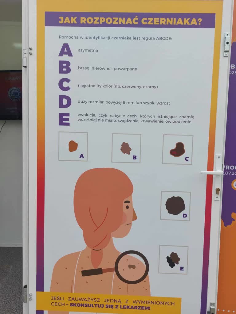 Wyprzedź czerniaka! Specjaliści badali mieszkańców Puław 2 517354366_761819112959241_5968330894978524859_n.jpg