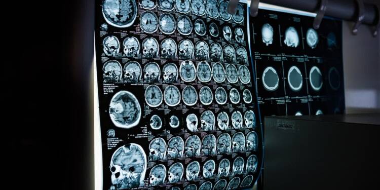 EAttachments9048553201f2c119c07f6ad8e9b5f0692048438 xl