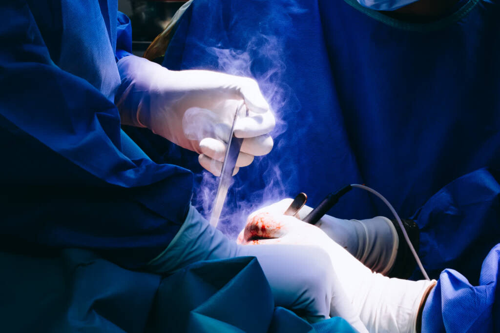 Pierwsza w Polsce! Innowacyjna operacja w lubelskim szpitalu 3 EAttachments90048736639b4f9a7d691caaf5915e379514971 xl