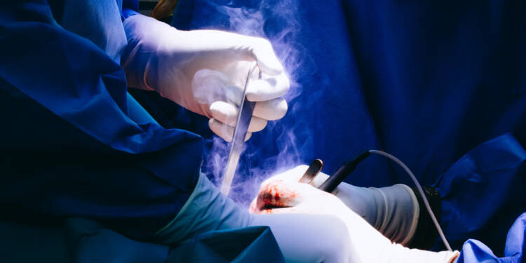 Pierwsza w Polsce! Innowacyjna operacja w lubelskim szpitalu 1 EAttachments90048736639b4f9a7d691caaf5915e379514971 xl