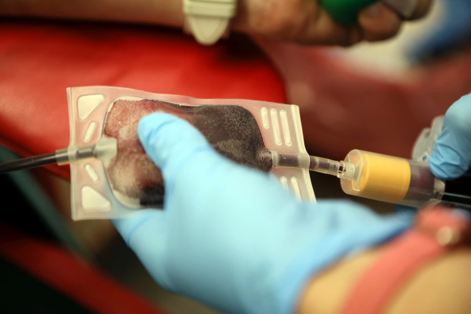 Warto oddawać krew. Lekarz: To bezcenny dar