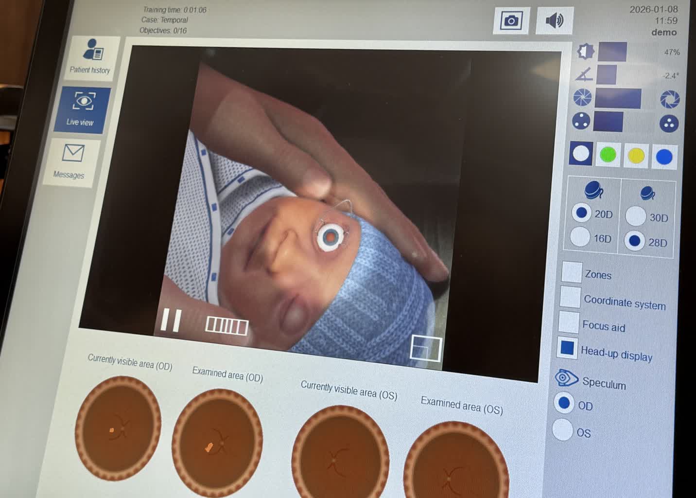 Ułatwi badanie wcześniaków. Sprzęt WOŚP trafił do lubelskiego szpitala [ZDJĘCIA]