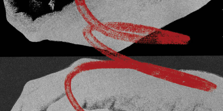 EAttachments9342133910938e46e98f425fe2fbd740755731d xl