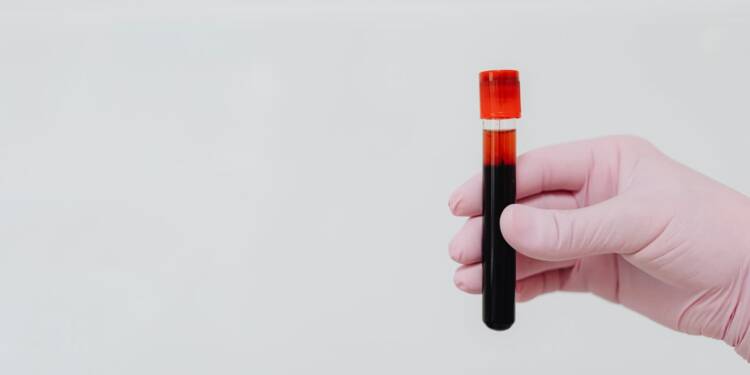 EAttachments9458338c674f4b75c209f60da7dc69615f8b7c5 xl