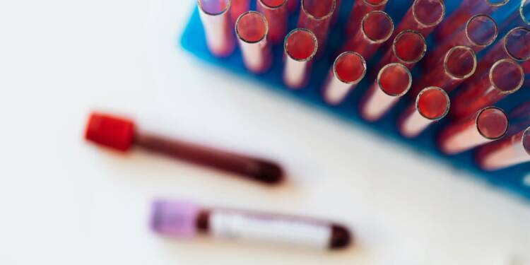 02.06.2026 Na zdrowie - o chorobach hematologicznych 1 EAttachments95534304fbb75b2ea0bdbcea8b09d8b77cb4a1d xl